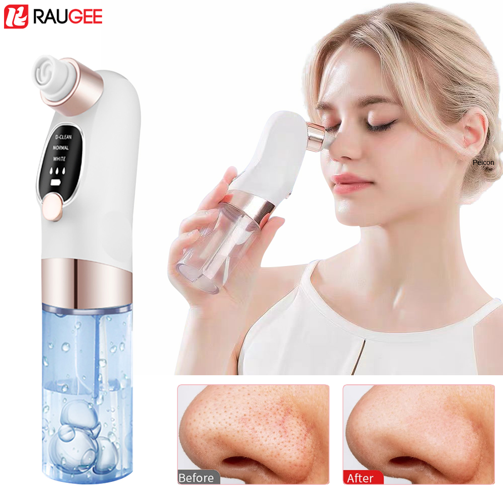 Pore Vacuum - Extracteur de points noirs électrique extracteur