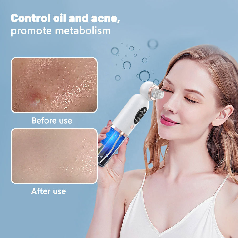 Pore Vacuum - Extracteur de points noirs et nettoyeur