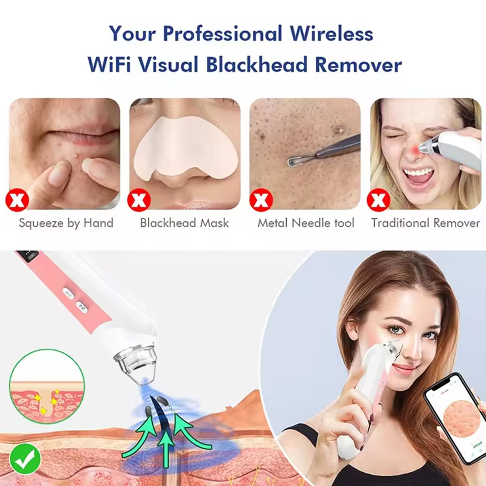 Nettoyeur de Pores à 6 Têtes,  - Pore Vacuum avis et prix