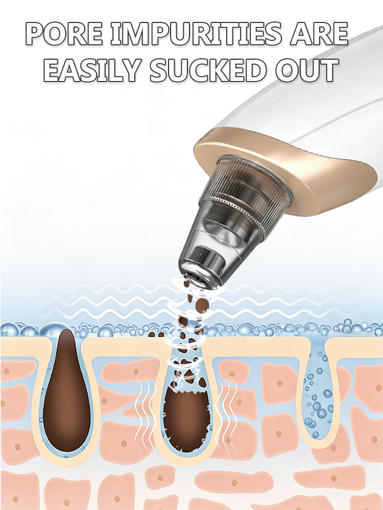 Extracteur de points noirs et  - Pore Vacuum avis et prix