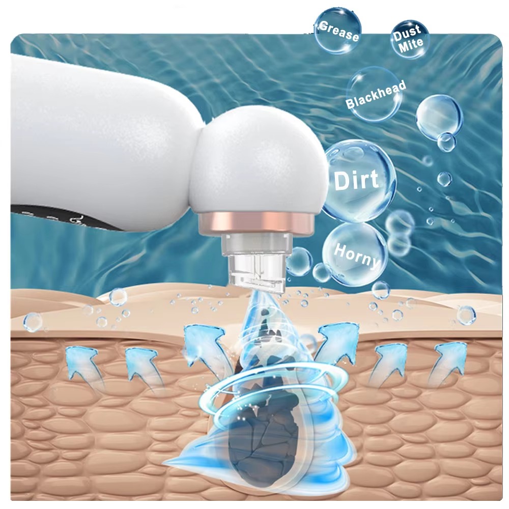 Extracteur de points noirs et  - Pore Vacuum avis et prix