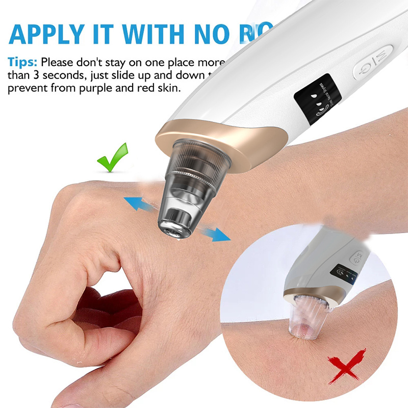 Appareil de nettoyage des pore - Pore Vacuum avis et prix